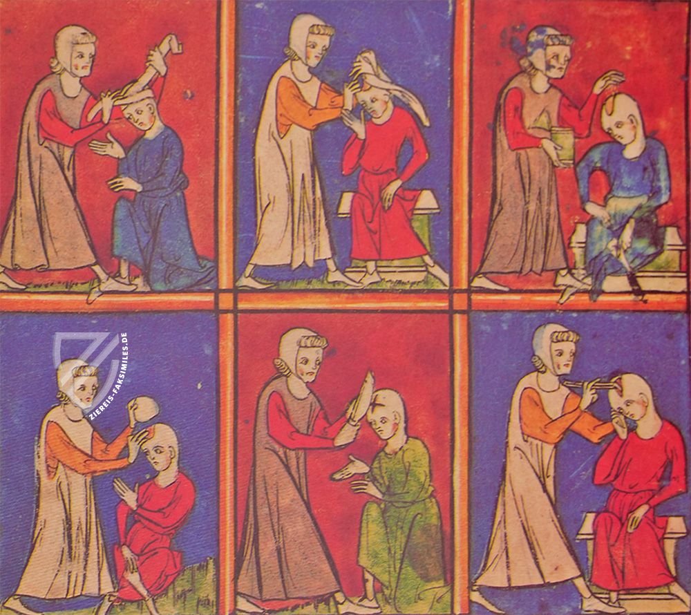 Chirurgia – Editions Medicina Rara – Codex Sloane 1977 – British Library (London, Vereinigtes Königreich)