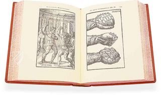 Hieronymus Mercurialis: De Arte Gymnastica – Editions Medicina Rara – Ah VI 1.4 – Universitätsbibliothek Tübingen (Tübingen, Deutschland)
