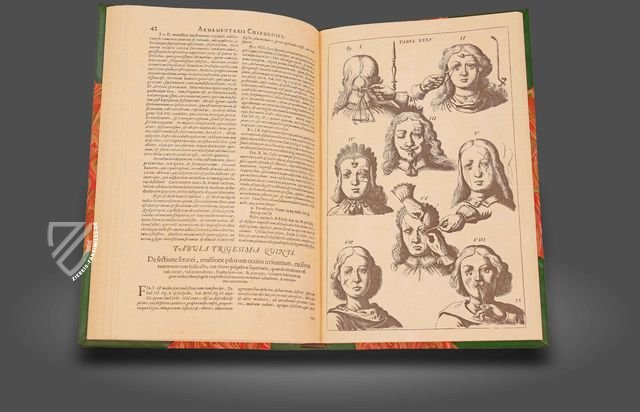 Scultetus: Armamentarium Chirurgicum – Editions Medicina Rara – Leopold-Sophien-Bibliothek (Überlingen, Deutschland) / Württembergische Landesbibliothek (Stuttgart, Deutschland) Scultetus: Armamentarium Chirurgicum – Editions Medicina Rara – Leopold-Sophien-Bibliothek (Überlingen, Deutschland) / Württembergische Landesbibliothek (Stuttgart, Deutschland)