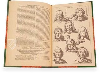 Scultetus: Armamentarium Chirurgicum – Editions Medicina Rara – Leopold-Sophien-Bibliothek (Überlingen, Deutschland) / Württembergische Landesbibliothek (Stuttgart, Deutschland)