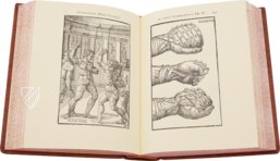 Hieronymus Mercurialis: De Arte Gymnastica – Editions Medicina Rara – Ah VI 1.4 – Universitätsbibliothek Tübingen (Tübingen, Deutschland)