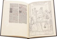 Johannes de Ketham: Fasciculus Medicinae – Editions Medicina Rara – Museum Otto Schäfer (Schweinfurt, Deutschland)