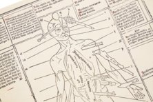 Johannes de Ketham: Fasciculus Medicinae – Editions Medicina Rara – Museum Otto Schäfer (Schweinfurt, Deutschland)