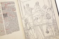 Johannes de Ketham: Fasciculus Medicinae – Editions Medicina Rara – Museum Otto Schäfer (Schweinfurt, Deutschland)