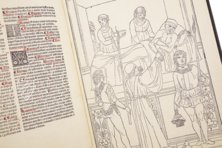 Johannes de Ketham: Fasciculus Medicinae – Editions Medicina Rara – Museum Otto Schäfer (Schweinfurt, Deutschland)