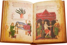 Medicina Antiqua – Club du Livre – Cod. Vindob. 93 – Österreichische Nationalbibliothek (Wien, Österreich)