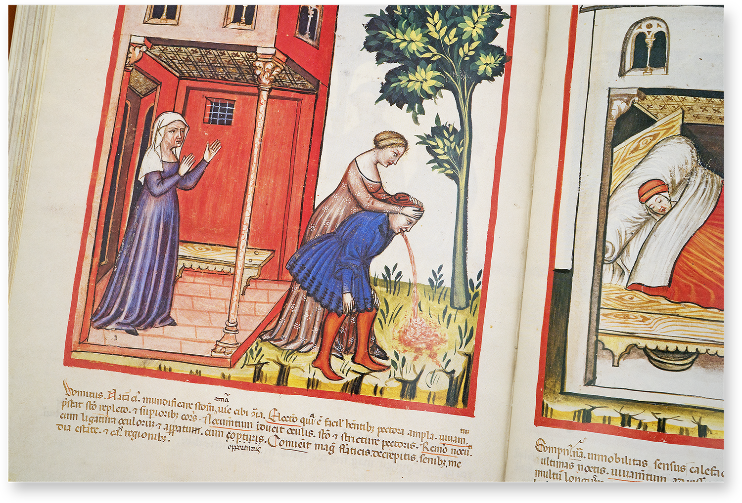 Erbrechen (vomitus) und Schlaf (sompnus) im Tacuinum Sanitatis in Medicina